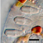 A light micrograph of a small area of a cell containing oblong-shaped un-extruded nematocysts.