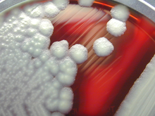 "B. cereus" colonies on a sheep-blood agar plate