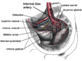 Imaging showing the inferior vesical, inferior pudendal and middle rectal arteries arising from the internal iliac arteries.