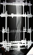 X-ray of the fracture site and the emplaced apparatus, two months post-fracture; perspective 2-4.