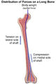 長骨的受力分佈(以股骨為例)