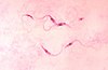 Photomicrograph of Trypanosoma cruzi parasites (Chagas disease pathogen).