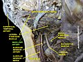 Maxillary artery