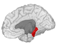 右側大腦半球（海馬旁迴位於紅色標記處）