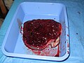 Placenta