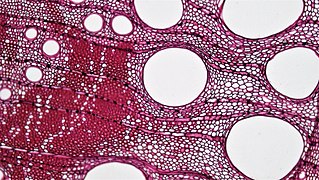 栎树树干的横切面，少数特别大的细胞为导管（英语：vessel elements），其周围的多数细胞为管胞，染色特别深者则为纤维细胞