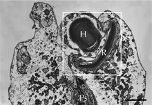 Grayscale electron micrograph of an ocelloid in its cellular context. Due to the microscopy technique used, the normally translucent hyalosome appears almost as darkly stained as the retinal body.