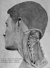 Relationship of the vertebral artery to the suboccipital muscles.