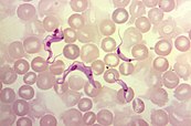 Photomicrograph of Trypanosoma cruzi parasites