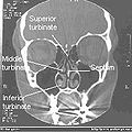 Normal Nose CT Front cross section