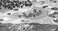 Osteoclast displaying many nuclei within its "foamy" cytoplasm.