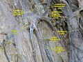 Superficial veins oflower limb. Superficial dissection. Anterior view.