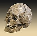 Image 5Skull of the Théviec burial. Female 25 to 35 years died a violent death with numerous skull fractures and bone lesions associated with the impacts of arrow.