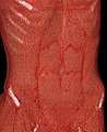 Volume rendering of abdominal muscles