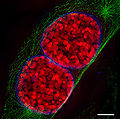 两个老鼠的细胞核的在前期的。