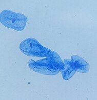 Human cheek cells w/ Methylene