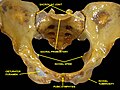 Anterior view of the body pelvis from a dissection. Pubic symphysis anteriorly.