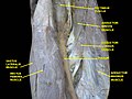 Muscles of thigh. Anterior views