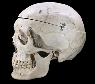 Modern human skull, exhibiting a different jaw-to-cranium ratio