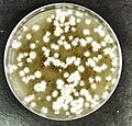 Cryptococcus gattii