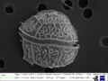 Unknown dinoflagellate under SEM (Dinophyceae)