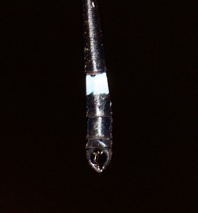 Anal appendages (male)