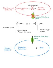 diagram explaining pathophysiology of CD