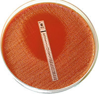 Bacteria are growing on an agar plate upon which a strip containing varying concentrations of antibiotics has been placed. An elliptical zone without growth is present around areas with higher concentrations of the antibiotic.