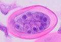 Cross-section of early enterobius vermicularis egg