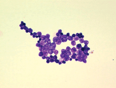 Prototheca wickerhamii, an infectious alga