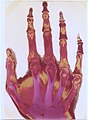 Original: X-Ray image of right hand; colored 1st. order equidensity-series using pseudo-solarization, B&W copies chromogenic developed