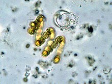 "Anabaena spiroides"