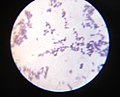 Candida albicans