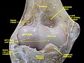 Elbow joint. Deep dissection. Anterior view.