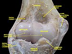 Elbow joint. Deep dissection. Anterior view.