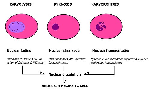 Morphological characteristics of pyknosis and other forms of nuclear destruction.
