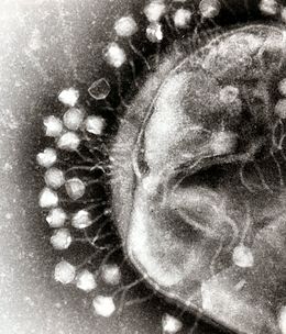 Transmission electron micrograph of multiple bacteriophages attached to a bacterium