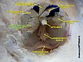 Medial rectus muscle