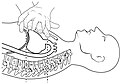 The ejection of blood from the heart is conditioned by the compression of the sternum by a third of the height of the chest