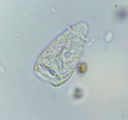 Vorticella sp. telotroch