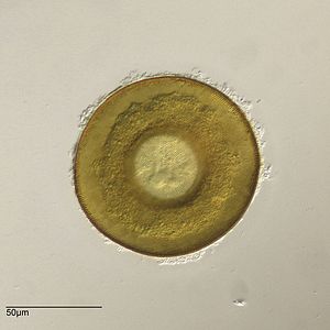 The autogenic test of Arcella discoides, made up of organic plates