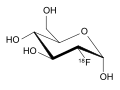 Fludeoxyglucose (18F)