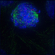 Early prometaphase: The nuclear membrane has just disassembled, allowing the microtubules to quickly interact with the kinetochores, which assemble on the centromeres of the condensing chromosomes.