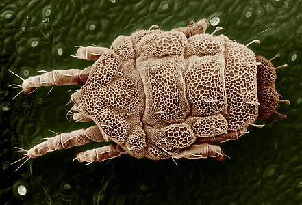 Scanning electromicrograph of a Lorryia formosa, by Eric Erbe and Chris Pooley.