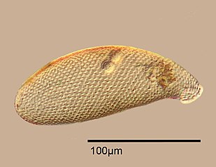 Testate amoeba, Cyphoderia sp.