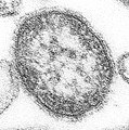 Measles (Paramyxoviridae)