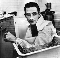 A dark-haired man looks on while his arm is placed in a tub of ice