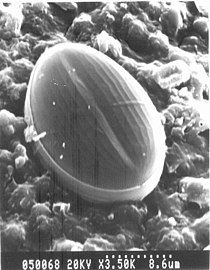 pennate diatom