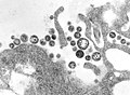 Lassa virus (Arenaviridae)