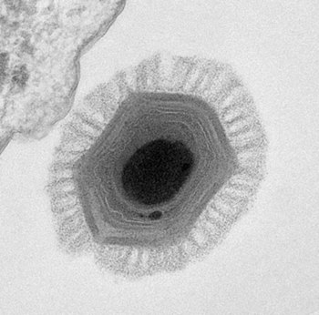 Electron micrograph of Megavirus chilensis